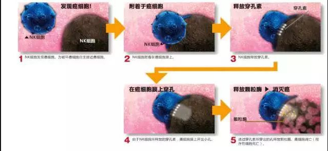 NK細胞：強大的抗癌前鋒！
